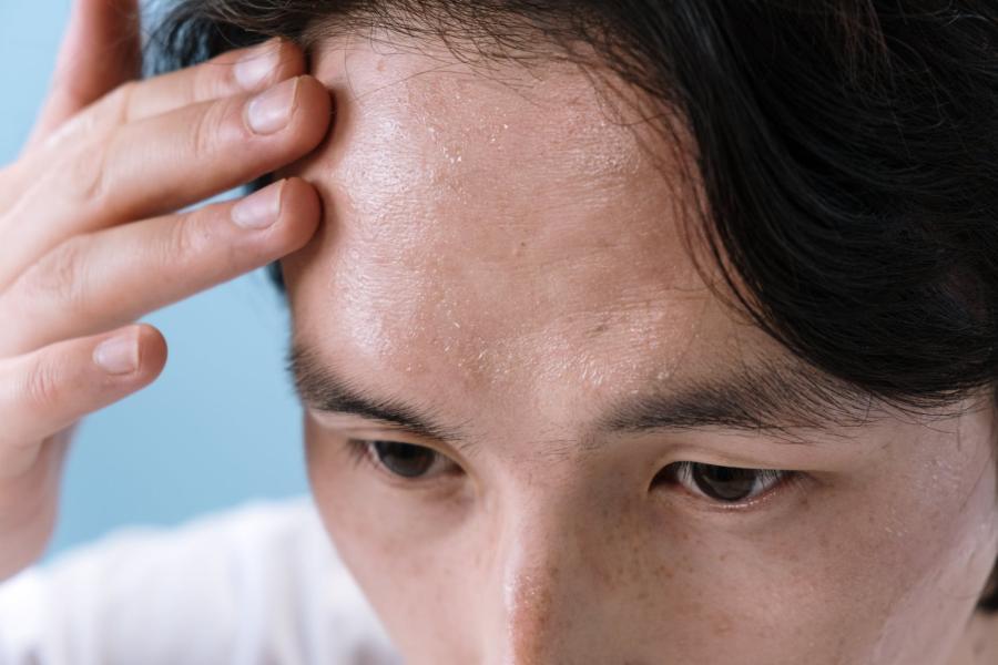Фото: Pexels | «Выпадение волос, повышение давления, бесплодие». Названа причина многих заболеваний