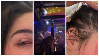 Угрожал убить: владивостокский ночной клуб стал местом жестокого избиения девушки