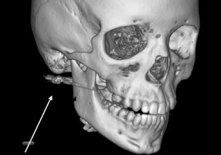 Уголовное дело против родителей завели в Приморье после ранения ребенка из винтовки