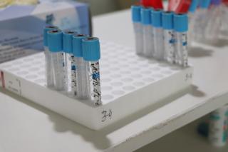 Фото: Екатерина Дымова / PRIMPRESS | В Приморье за сутки выявлен 151 случай заражения коронавирусом