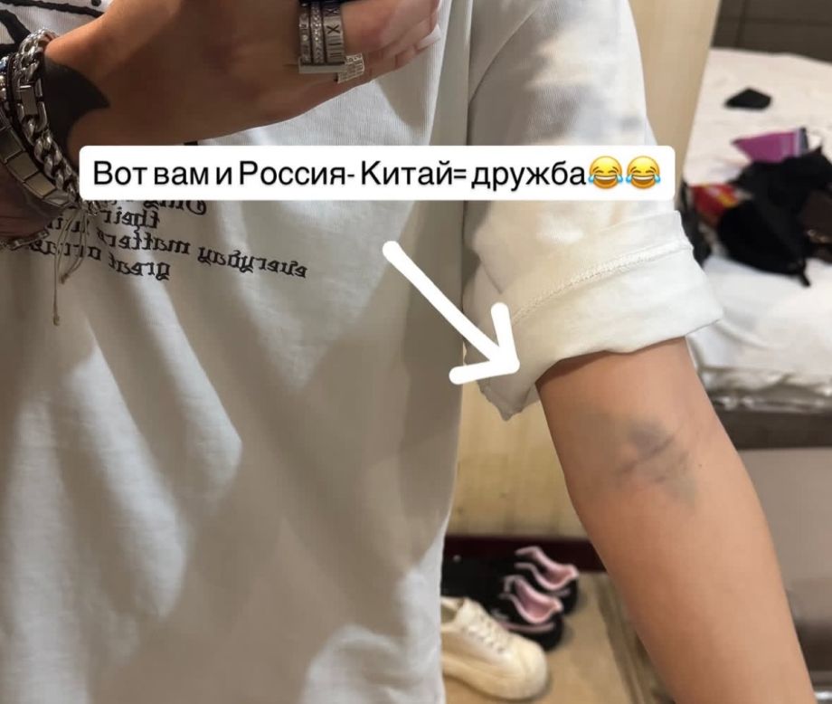 Жительница Приморья вернулась из Суйфэньхэ с синяками после ложного обвинения в краже