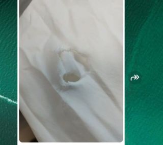 «Все в дырках»: популярная химчистка во Владивостоке опозорилась перед отелем