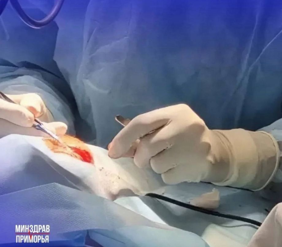 На волоске от слепоты: школьница из Приморья едва не лишилась зрения из-за пистолета