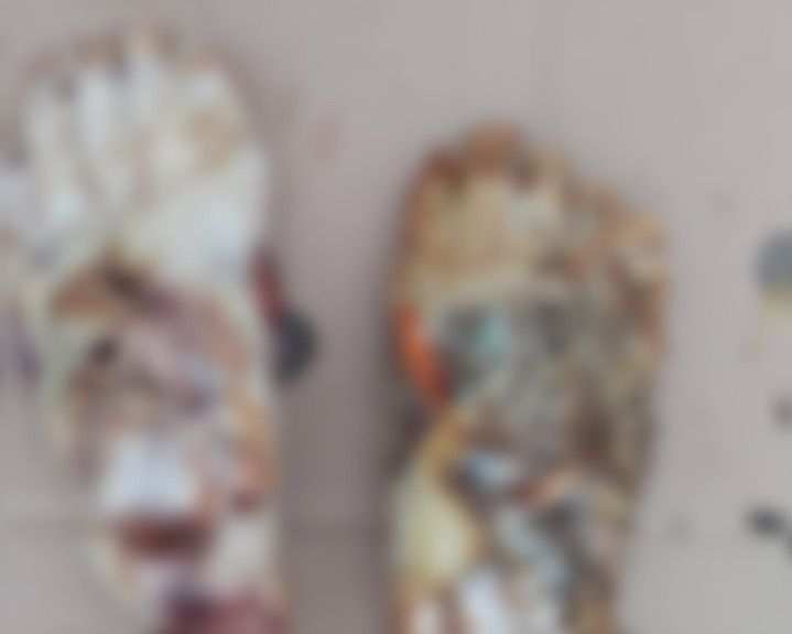 Кровь стынет в жилах: Отрубленные стопы в мусорке нашли во Владивостоке